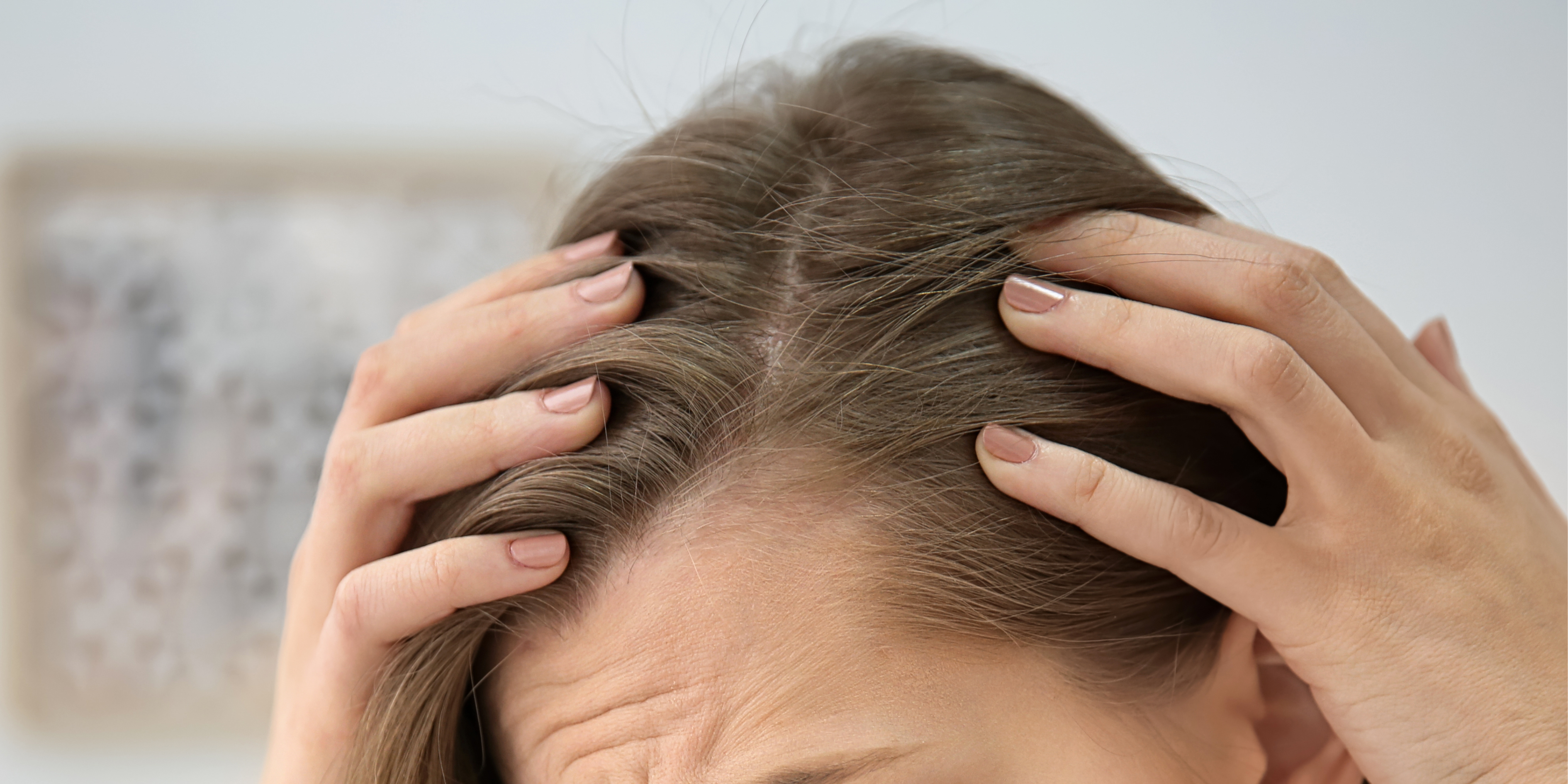 The 7 Biggest Hair Problems People Google — and How to Fix Them, Naturally