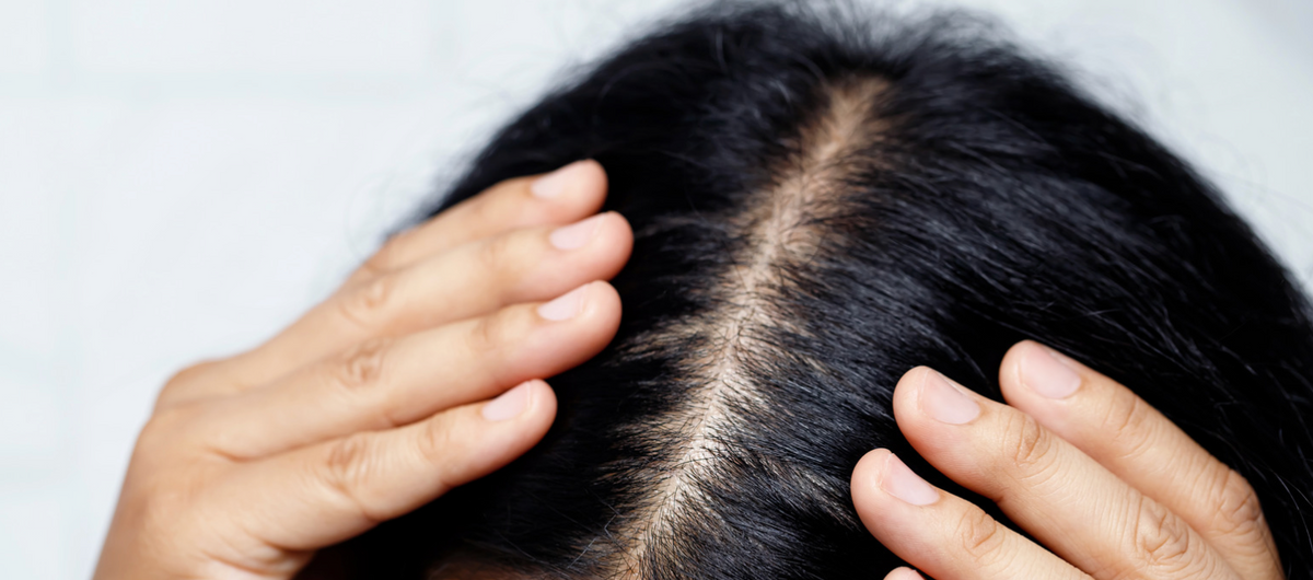 Your Scalp Is Skin: Why Your Haircare Deserves More Thought